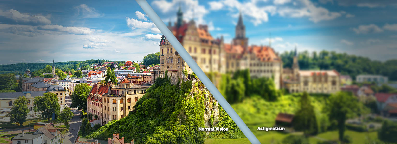 Astigmatism Treatment in Hugo
