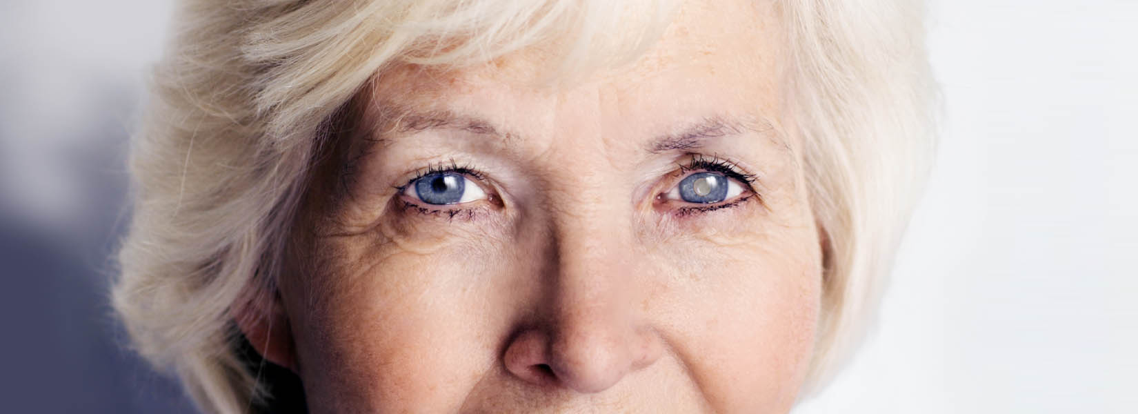 Cataract Surgery in Hugo