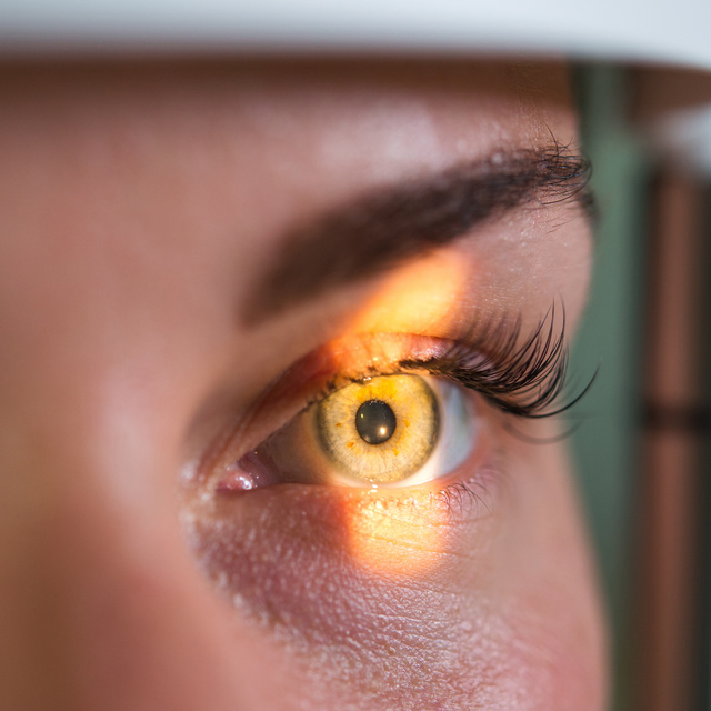 Vision Therapy in Hugo